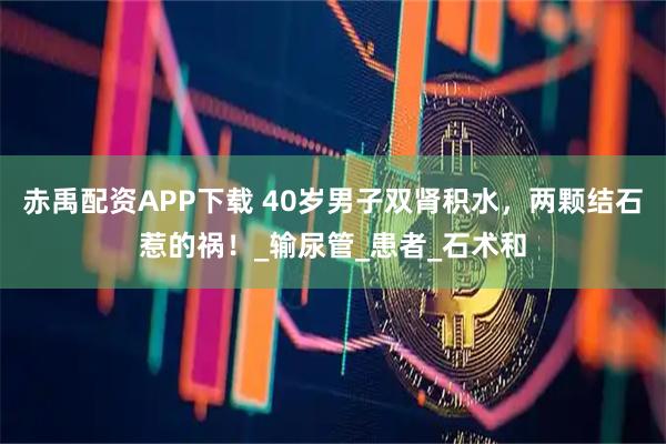 赤禹配资APP下载 40岁男子双肾积水，两颗结石惹的祸！_输尿管_患者_石术和